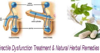 Erectile Dysfunction Treatment & Natural remedy